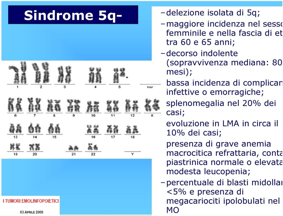 nel 20% dei casi; evoluzione in LMA in circa il 10% dei casi; presenza di grave anemia macrocitica refrattaria, conta