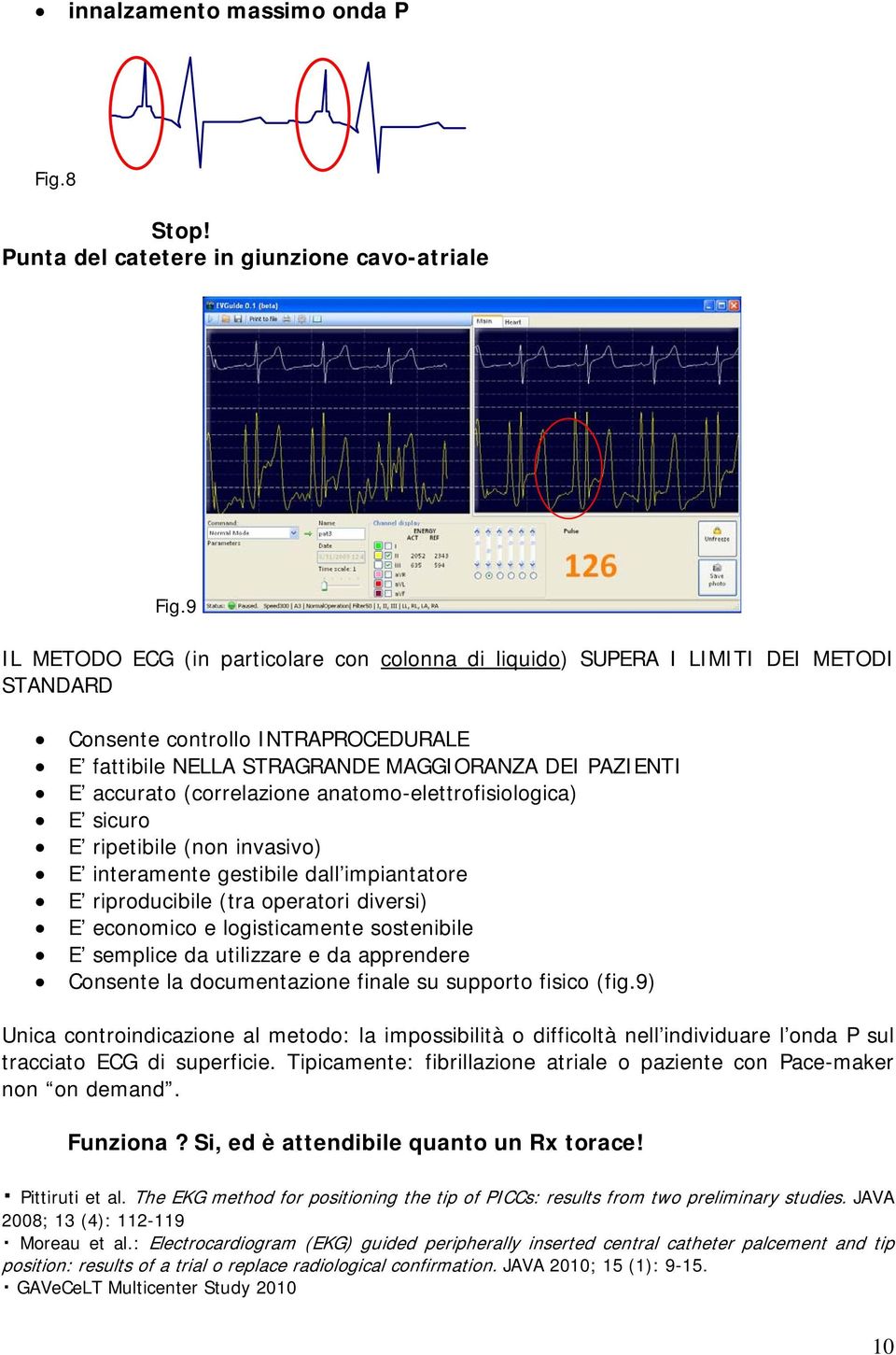 (correlazione anatomo-elettrofisiologica) E sicuro E ripetibile (non invasivo) E interamente gestibile dall impiantatore E riproducibile (tra operatori diversi) E economico e logisticamente