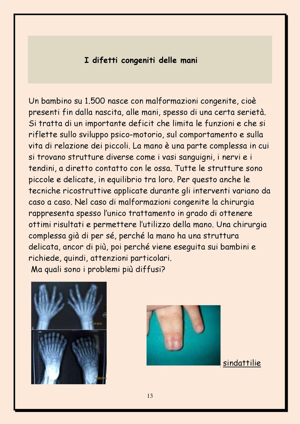 La mano è una parte complessa in cui si trovano strutture diverse come i vasi sanguigni, i nervi e i tendini, a diretto contatto con le ossa.