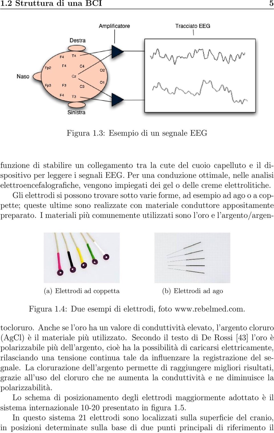 Gli elettrodi si possono trovare sotto varie forme, ad esempio ad ago o a coppette; queste ultime sono realizzate con materiale conduttore appositamente preparato.