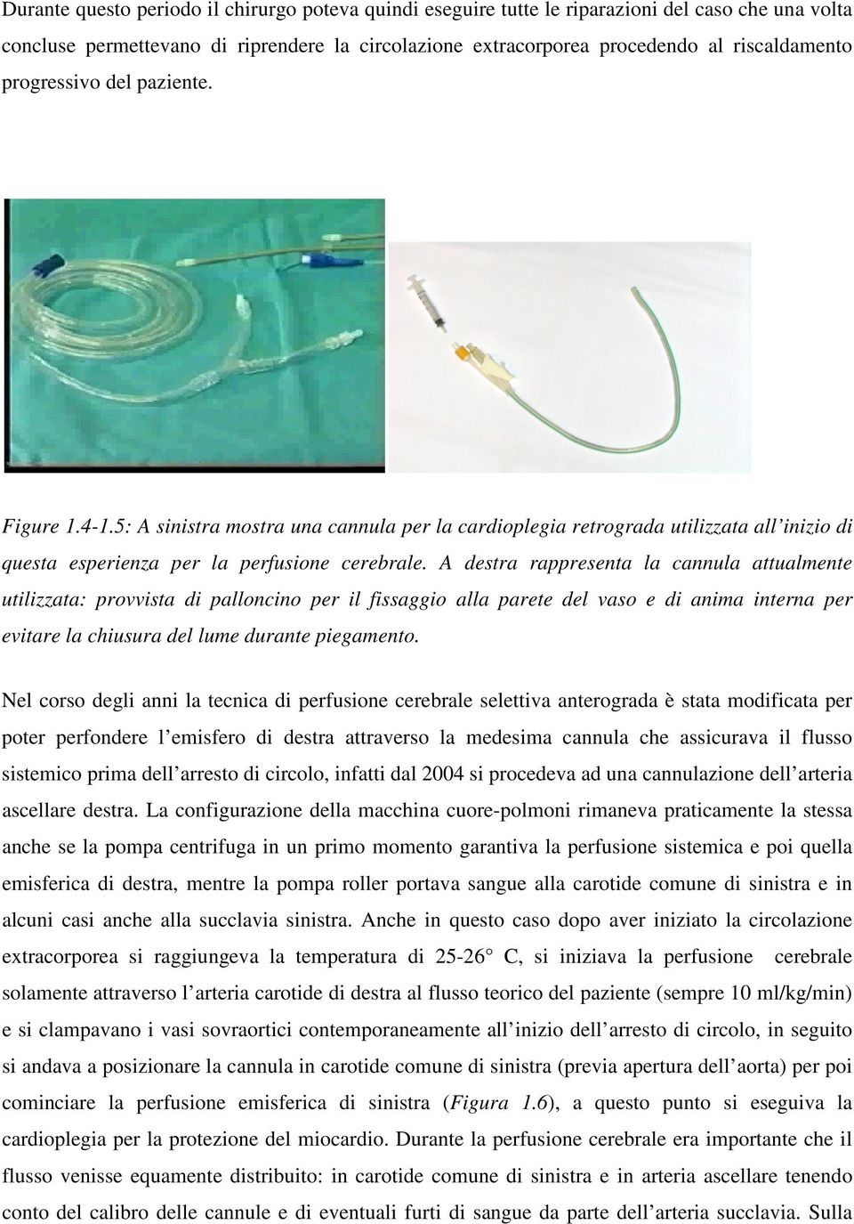 A destra rappresenta la cannula attualmente utilizzata: provvista di palloncino per il fissaggio alla parete del vaso e di anima interna per evitare la chiusura del lume durante piegamento.