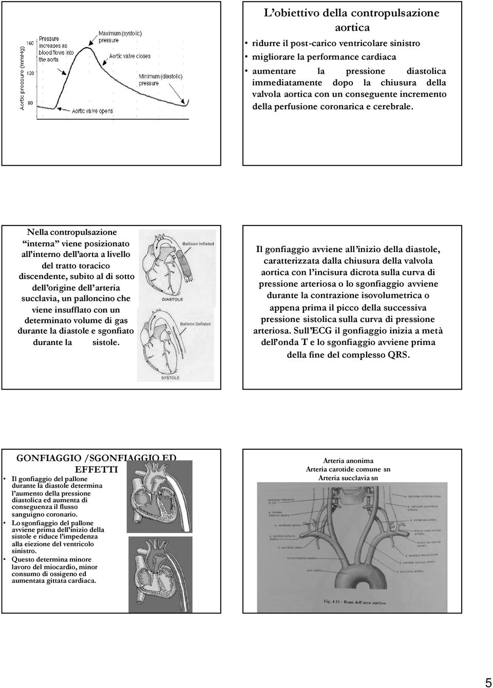 Nella contropulsazione interna viene posizionato all interno dell aorta a livello del tratto toracico discendente, subito al di sotto dell origine dell arteria succlavia, un palloncino che viene