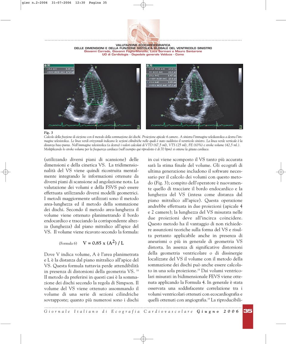 La linea verde verticale è la distanza base-punta. Nell immagine telesistolica (a destra) 