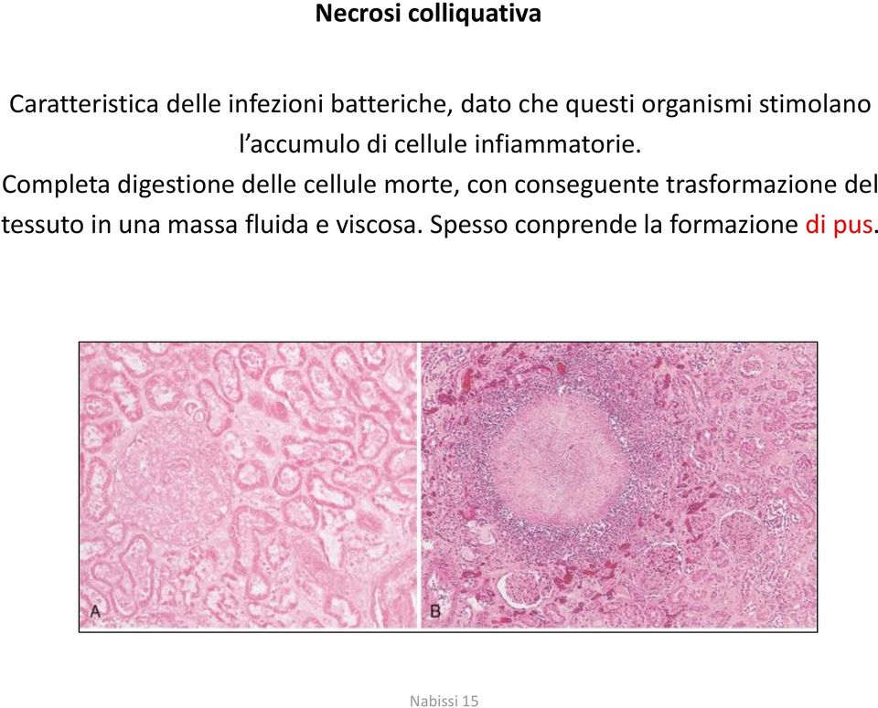 Completa digestione delle cellule morte, con conseguente trasformazione