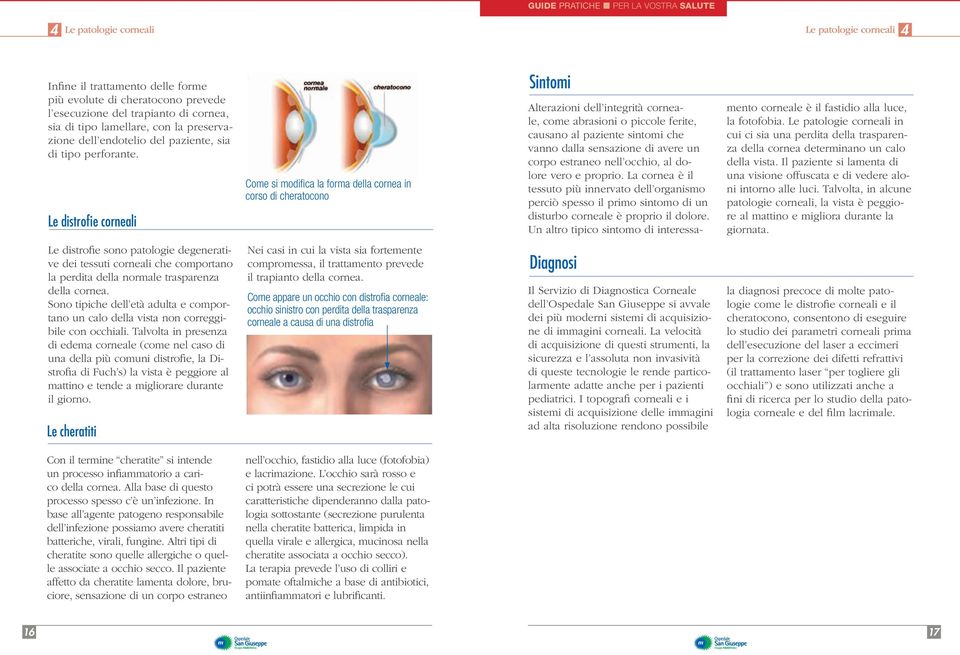 Le distrofie corneali Come si modifica la forma della cornea in corso di cheratocono Sintomi Alterazioni dell integrità corneale, come abrasioni o piccole ferite, causano al paziente sintomi che