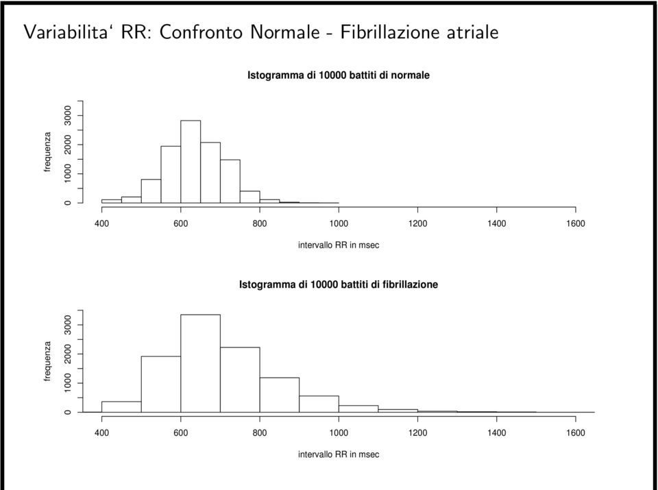 1400 1600 intervallo RR in msec Istogramma di 10000 battiti di