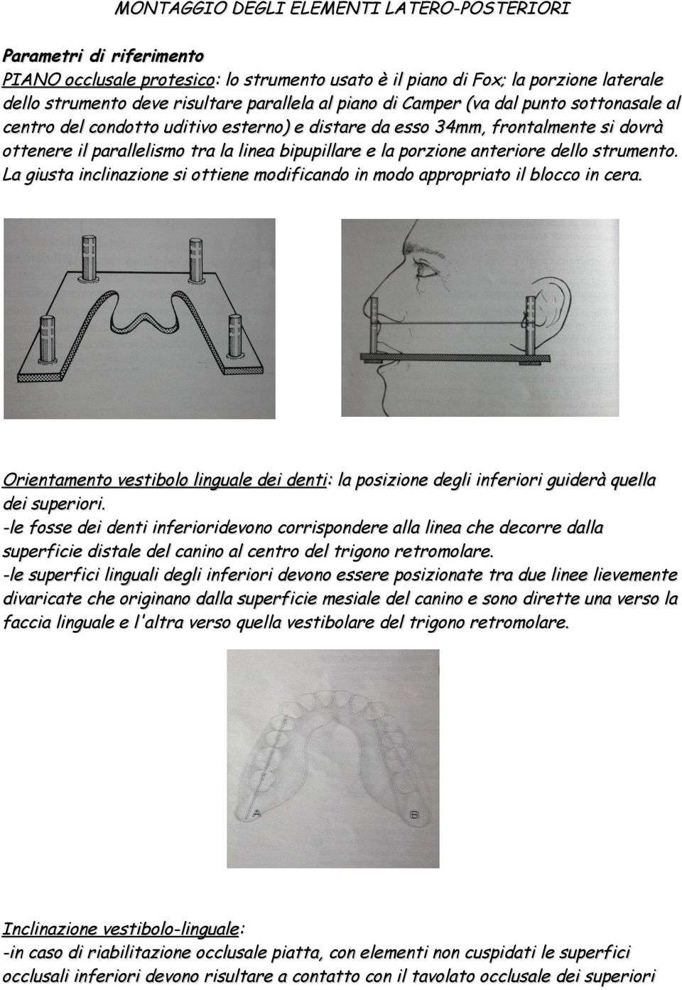 anteriore dello strumento. La giusta inclinazione si ottiene modificando in modo appropriato il blocco in cera.