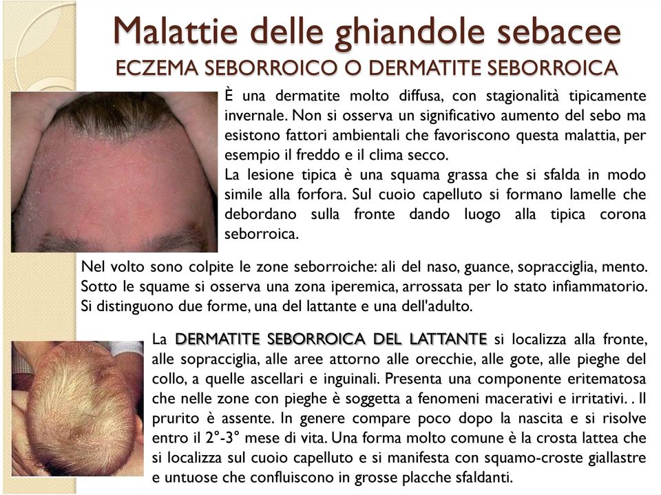 La lesione tipica è una squama grassa che si sfalda in modo simile alla forfora. Sul cuoio capelluto si formano lamelle che debordano sulla fronte dando luogo alla tipica corona seborroica.