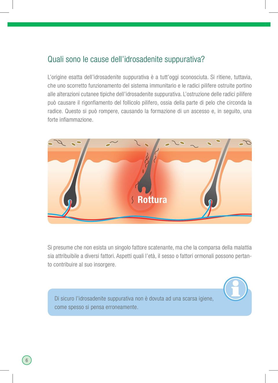 L ostruzione delle radici pilifere può causare il rigonfiamento del follicolo pilifero, ossia della parte di pelo che circonda la radice.