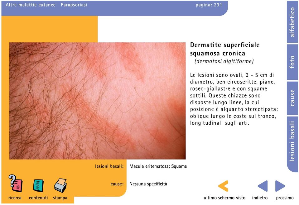 circoscritte, piane, roseo-giallastre e con squame sottili.