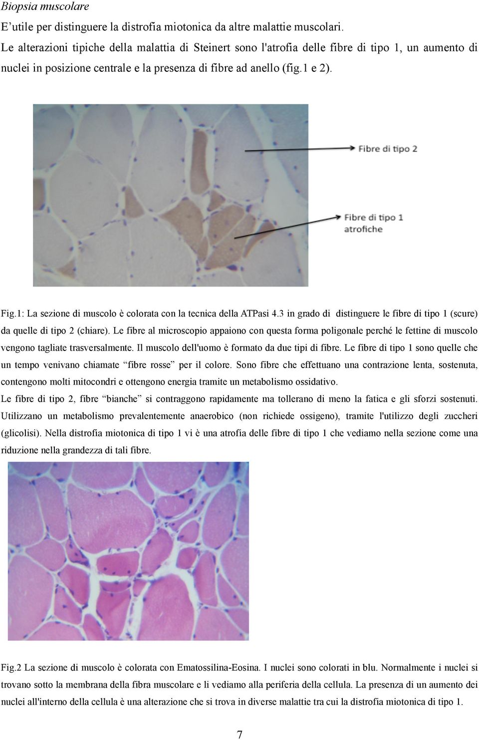 1: La sezione di muscolo è colorata con la tecnica della ATPasi 4.3 in grado di distinguere le fibre di tipo 1 (scure) da quelle di tipo 2 (chiare).