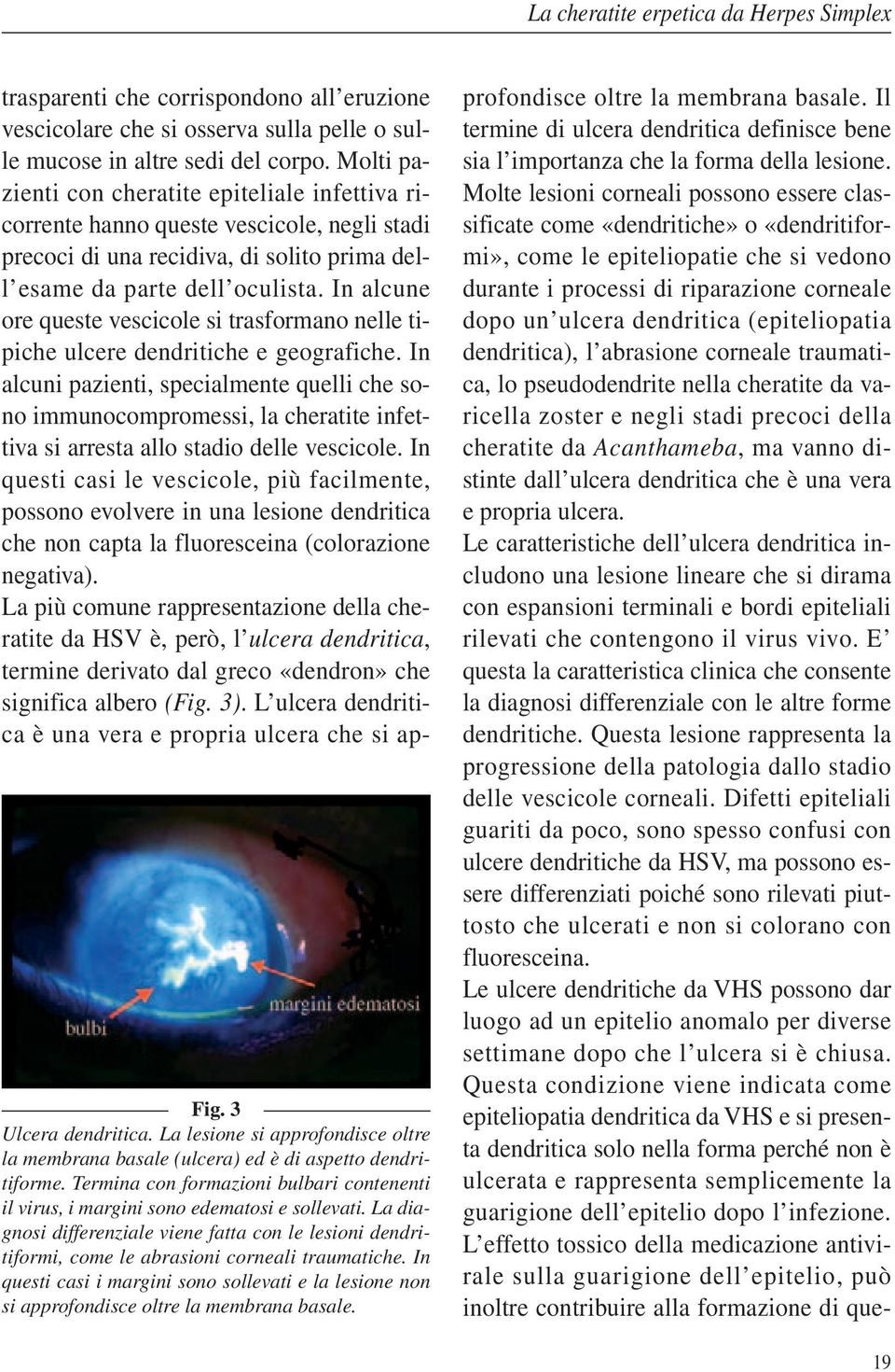 In alcune ore queste vescicole si trasformano nelle tipiche ulcere dendritiche e geografiche.