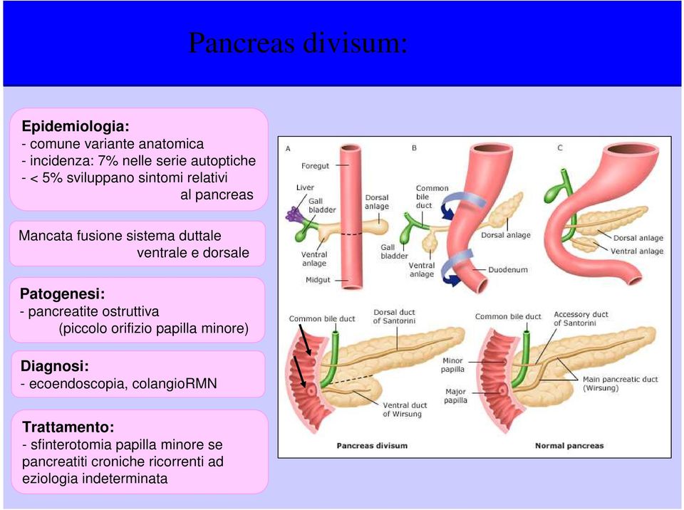 Patogenesi: - pancreatite ostruttiva (piccolo orifizio papilla minore) Diagnosi: - ecoendoscopia,