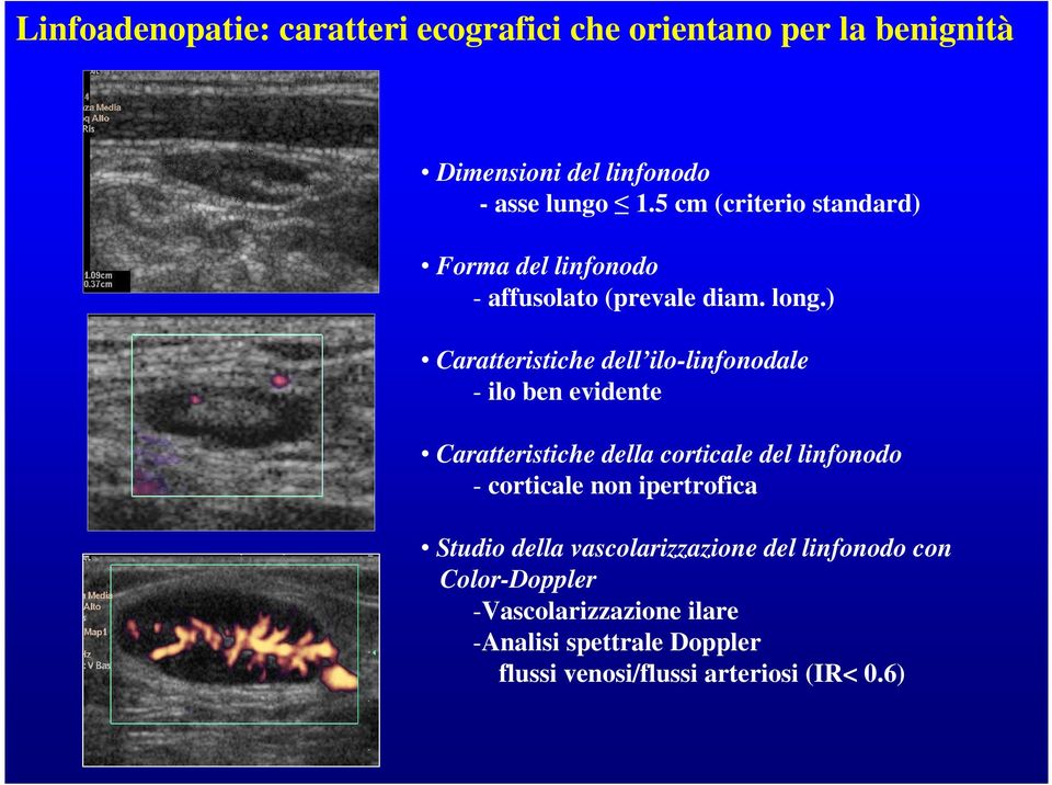 ) Caratteristiche dell ilo-linfonodale - ilo ben evidente Caratteristiche della corticale del linfonodo - corticale