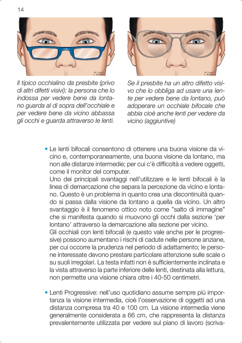 Se il presbite ha un altro difetto visivo che lo obbliga ad usare una lente per vedere bene da lontano, può adoperare un occhiale bifocale che abbia cioè anche lenti per vedere da vicino (aggiuntive)