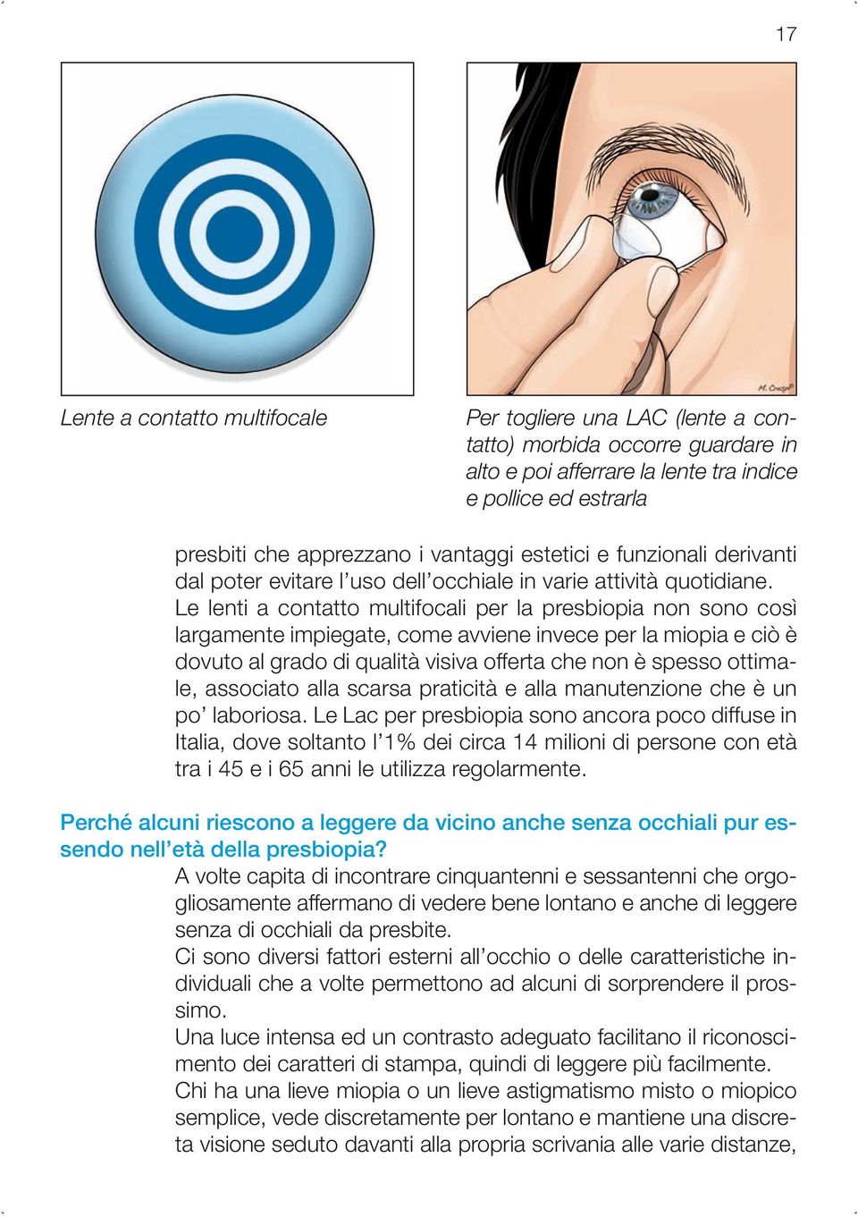 Le lenti a contatto multifocali per la presbiopia non sono così largamente impiegate, come avviene invece per la miopia e ciò è dovuto al grado di qualità visiva offerta che non è spesso ottimale,