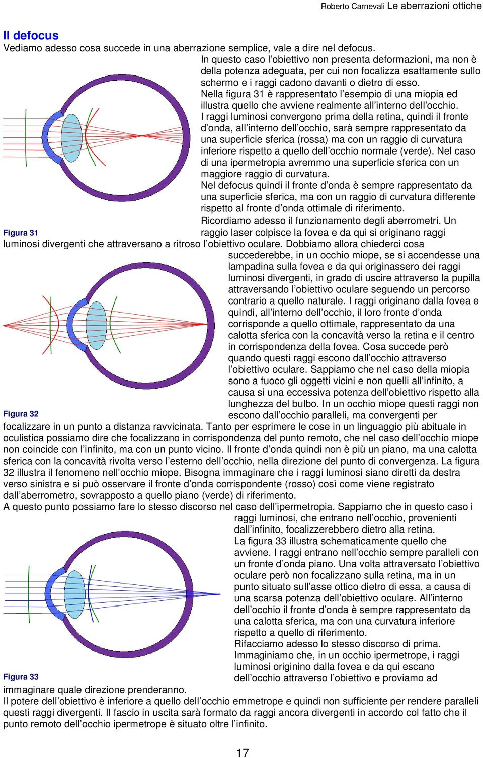 Nella figura 31 è rappresentato l esempio di una miopia ed illustra quello che avviene realmente all interno dell occhio.