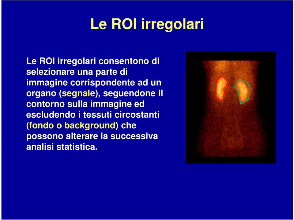 il contorno sulla immagine ed escludendo i tessuti circostanti