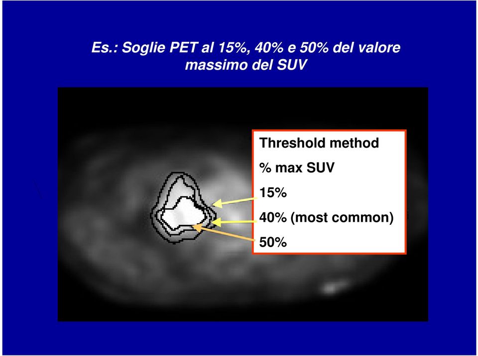 SUV Threshold method % max