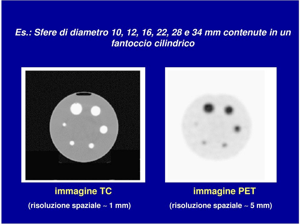 cilindrico immagine TC (risoluzione