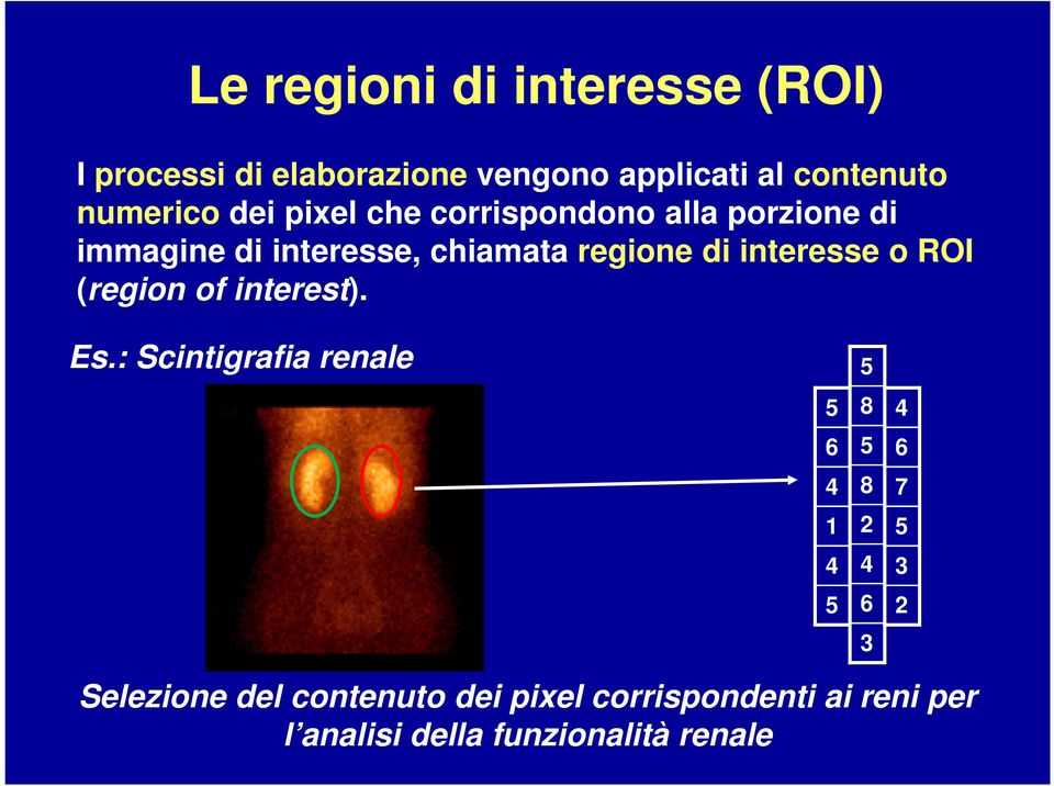 di interesse o ROI (region of interest). Es.
