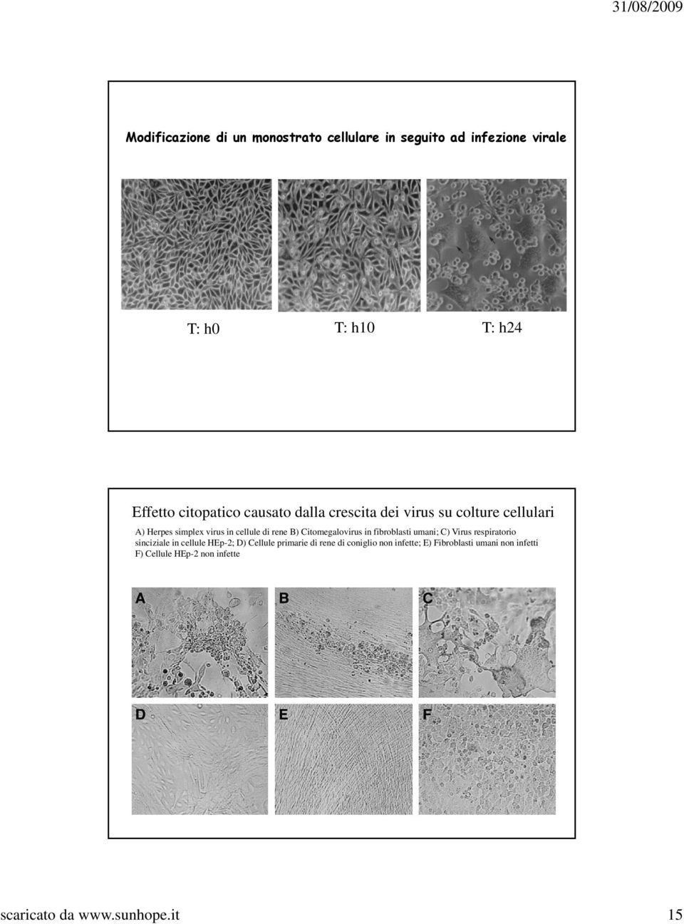 Citomegalovirus in fibroblasti umani; C) Virus respiratorio sinciziale in cellule HEp-2; D) Cellule primarie di