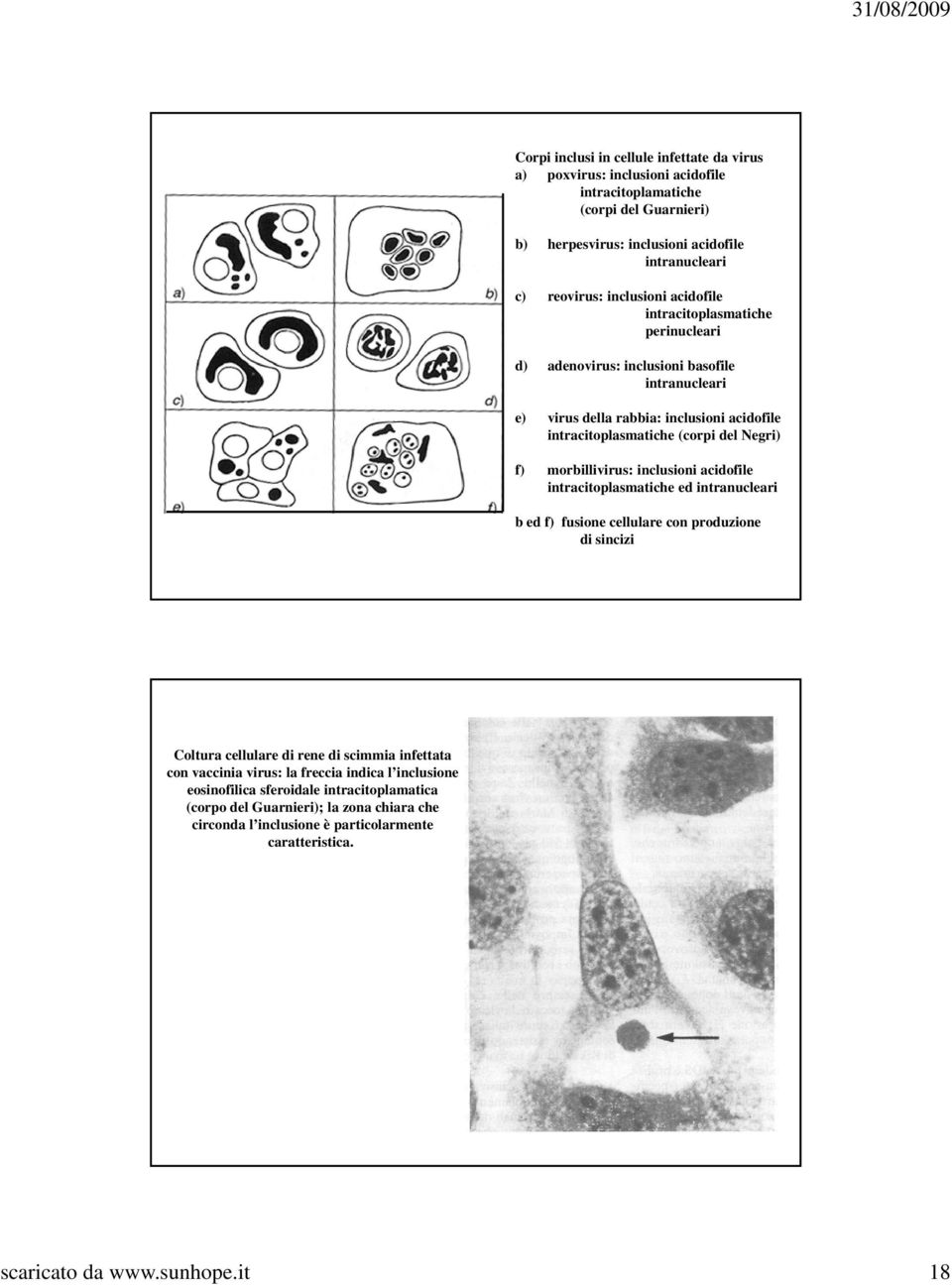 morbillivirus: inclusioni acidofile intracitoplasmatiche ed intranucleari b ed f) fusione cellulare con produzione di sincizi Coltura cellulare di rene di scimmia infettata con vaccinia virus: