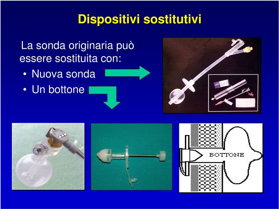 Nuova sonda Un bottone