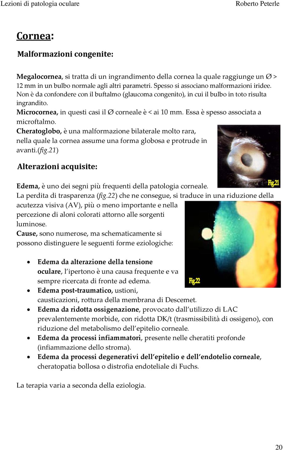 Essa è spesso associata a microftalmo. Cheratoglobo, è una malformazione bilaterale molto rara, nella quale la cornea assume una forma globosa e protrude in avanti.(fig.