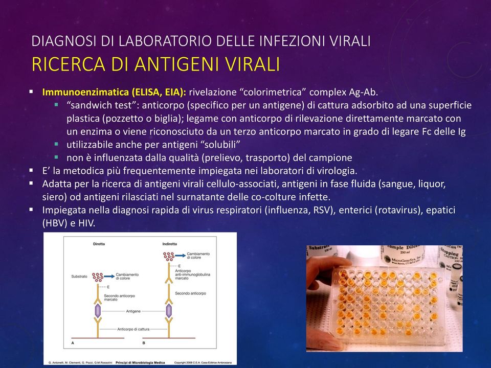 viene riconosciuto da un terzo anticorpo marcato in grado di legare Fc delle Ig utilizzabile anche per antigeni solubili non è influenzata dalla qualità (prelievo, trasporto) del campione E la