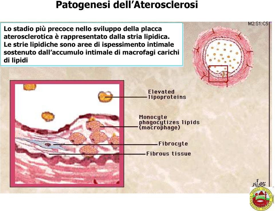 stria lipidica.