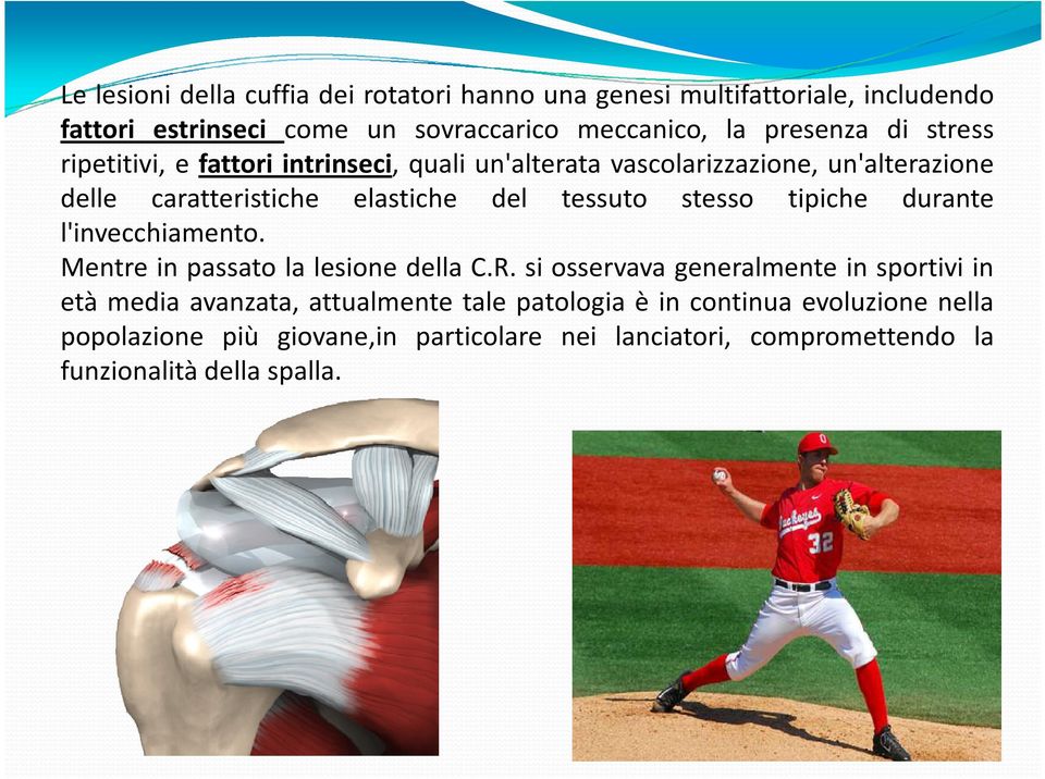 stesso tipiche durante l'invecchiamento. Mentre in passato la lesione della C.R.