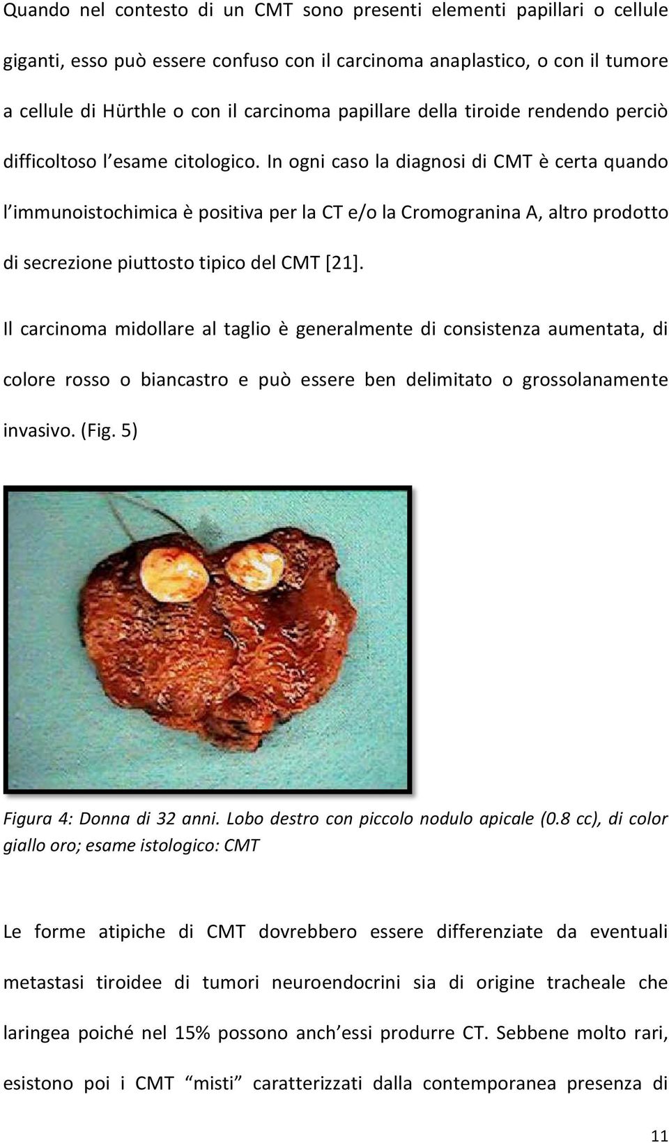 In ogni caso la diagnosi di CMT è certa quando l immunoistochimica è positiva per la CT e/o la Cromogranina A, altro prodotto di secrezione piuttosto tipico del CMT [21].