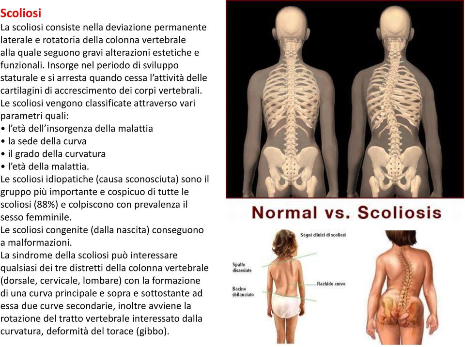 Le scoliosi vengono classificate attraverso vari parametri quali: l età dell insorgenza della malattia la sede della curva il grado della curvatura l età della malattia.