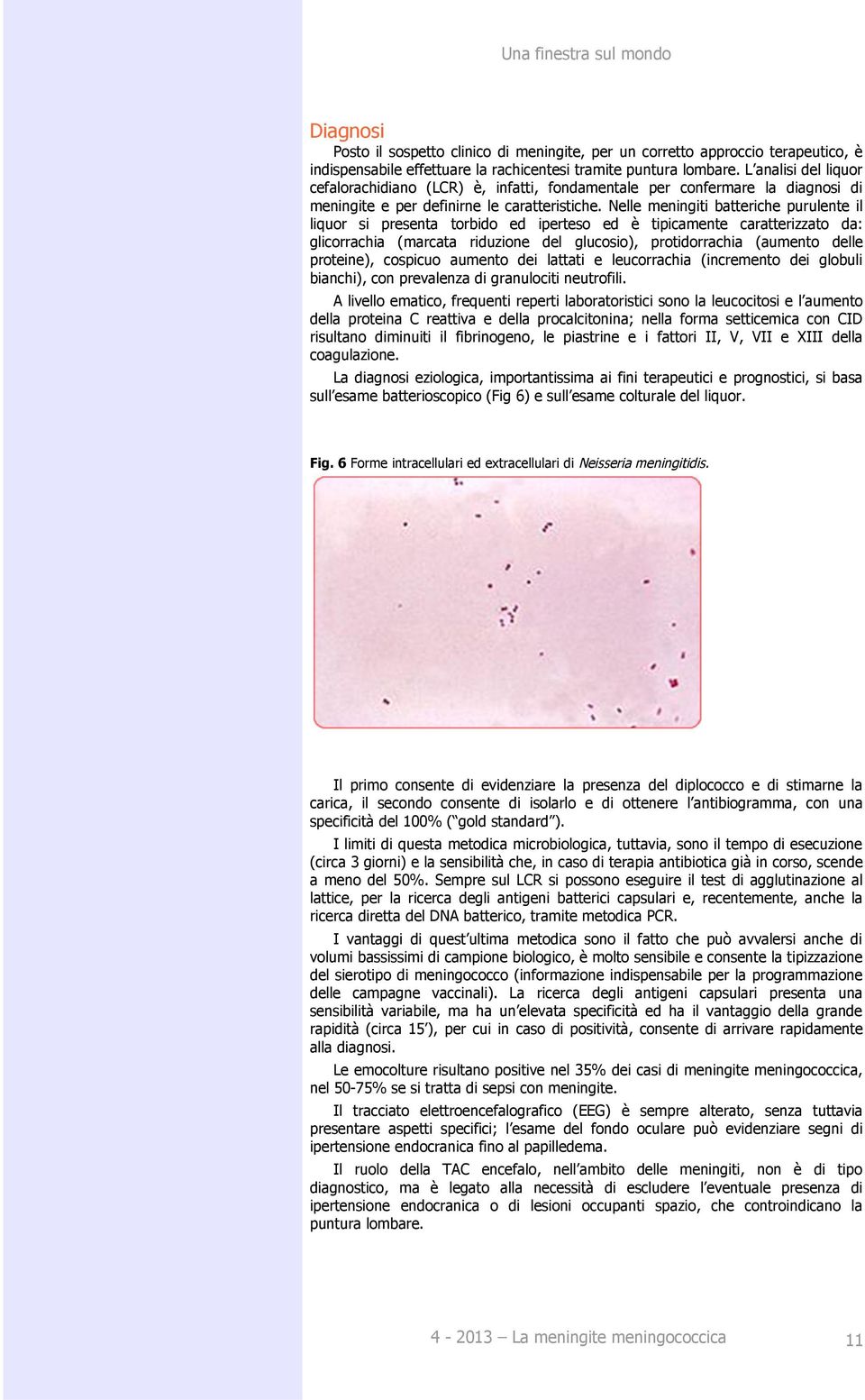 Nelle meningiti batteriche purulente il liquor si presenta torbido ed iperteso ed è tipicamente caratterizzato da: glicorrachia (marcata riduzione del glucosio), protidorrachia (aumento delle