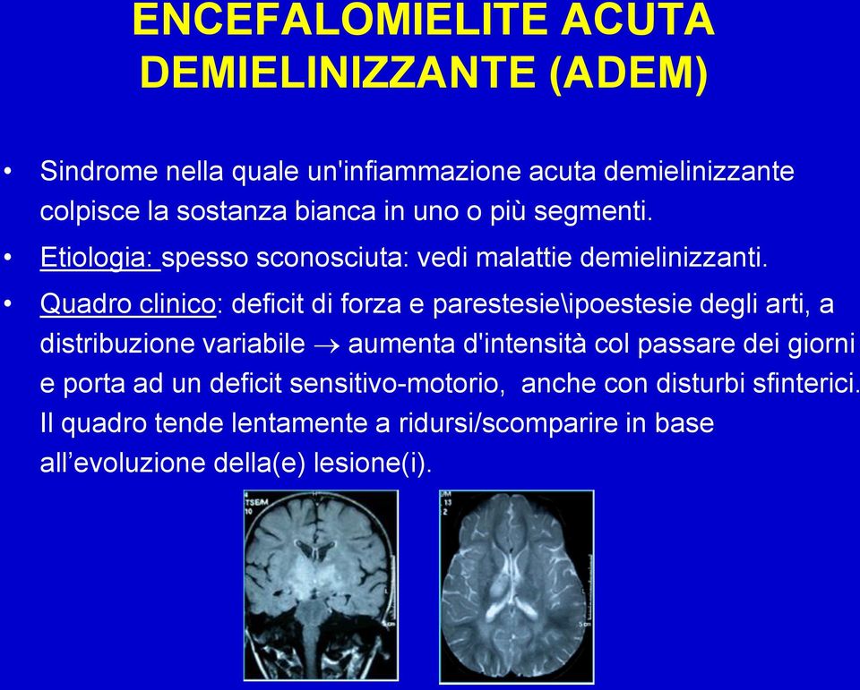 Quadro clinico: deficit di forza e parestesie\ipoestesie degli arti, a distribuzione variabile aumenta d'intensità col passare