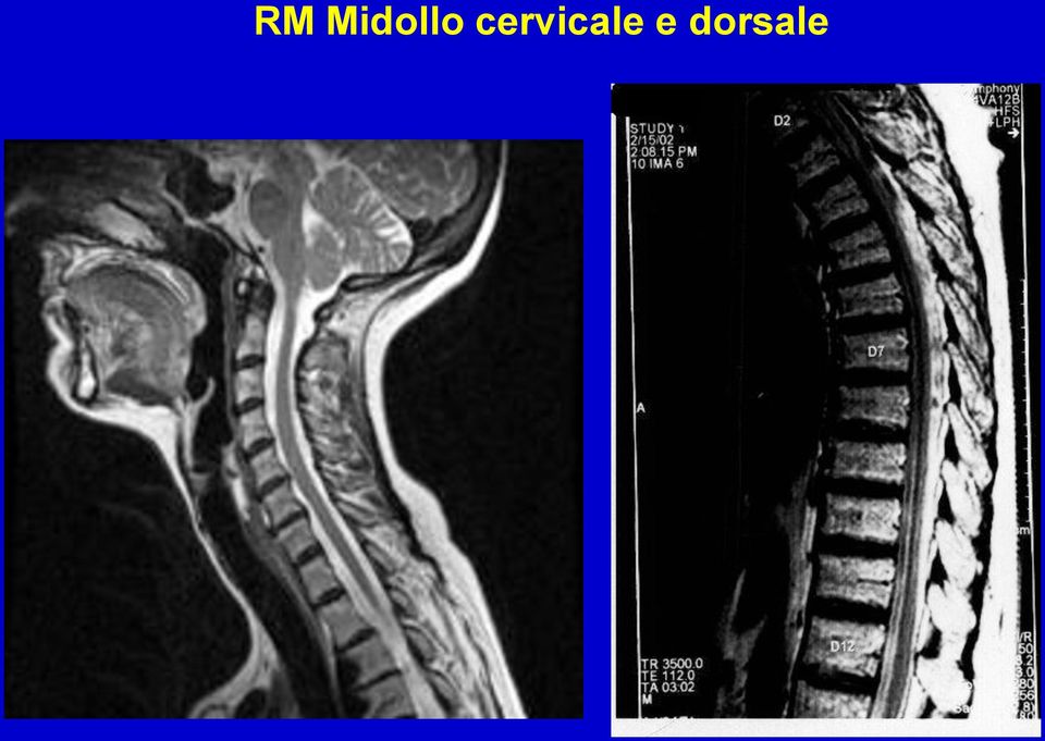 cervicale