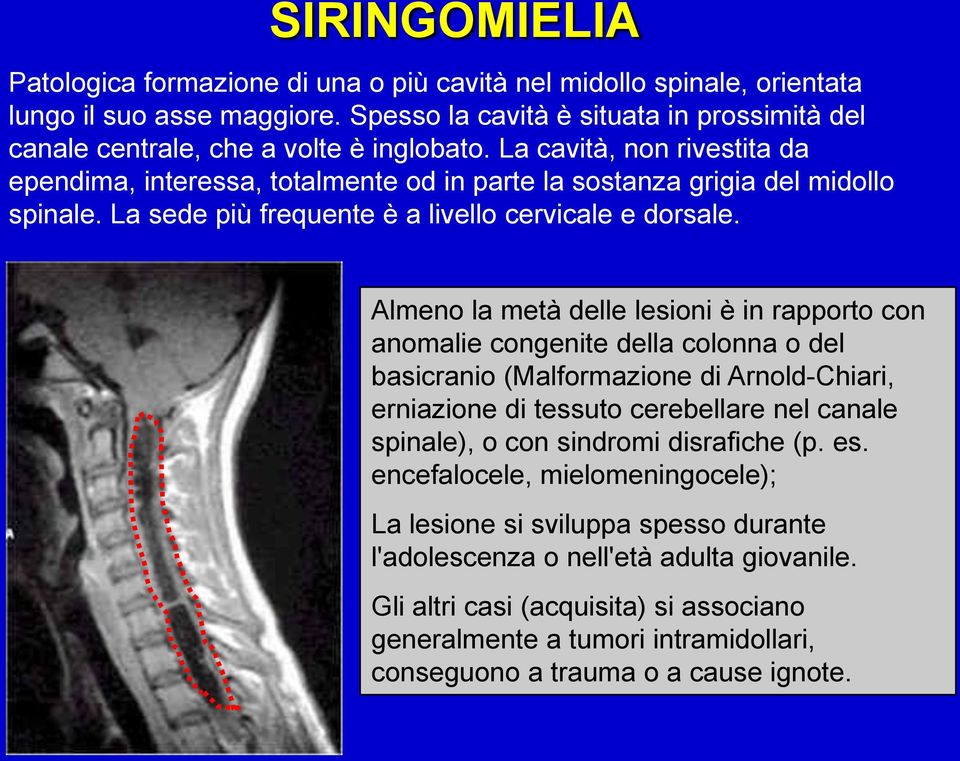 La sede più frequente è a livello cervicale e dorsale.