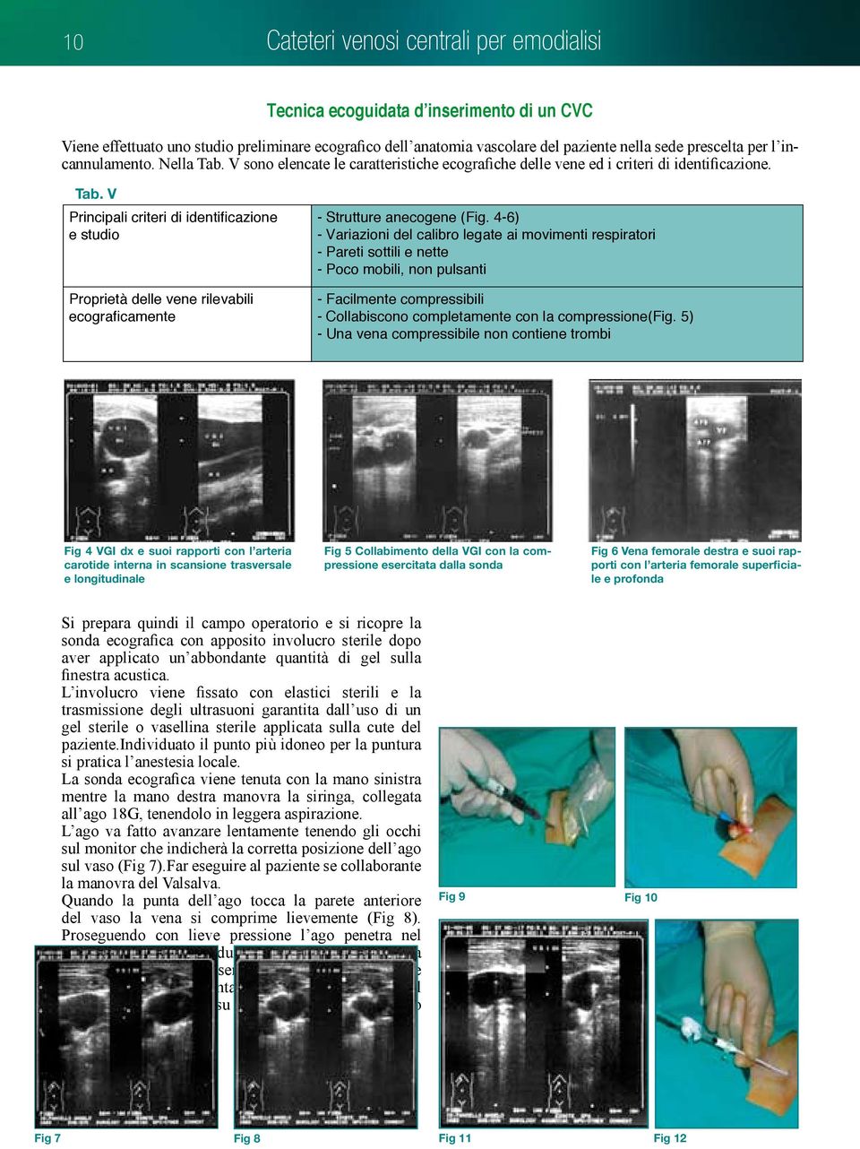 4-6) - Variazioni del calibro legate ai movimenti respiratori - Pareti sottili e nette - Poco mobili, non pulsanti - Facilmente compressibili - Collabiscono completamente con la compressione(fig.