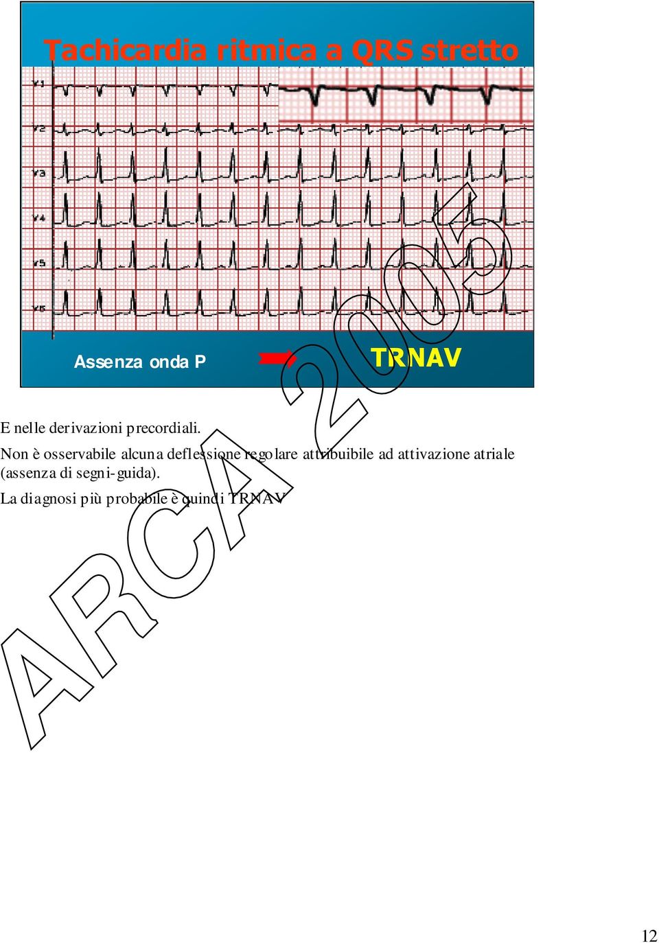 Non è osservabile alcuna deflessione regolare attribuibile