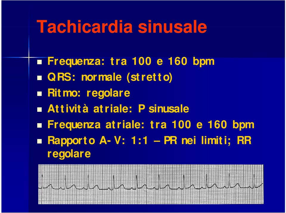 ità atriale: P sinusale Frequenza atriale: tra 100