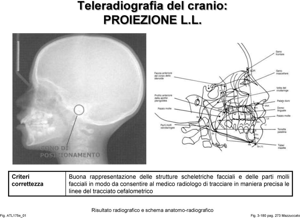 delle parti molli facciali in modo da consentire al medico radiologo di tracciare in