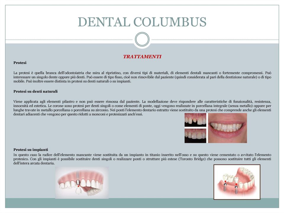 Può inoltre essere distinta in protesi su denti naturali o su impianti. Protesi su denti naturali Viene applicata agli elementi pilastro e non può essere rimossa dal paziente.