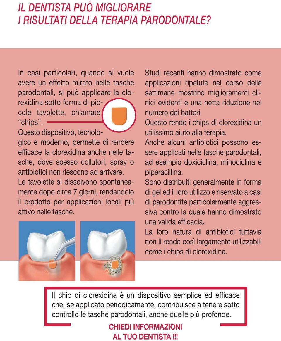 Questo dispositivo, tecnologico e moderno, permette di rendere efficace la clorexidina anche nelle tasche, dove spesso collutori, spray o antibiotici non riescono ad arrivare.