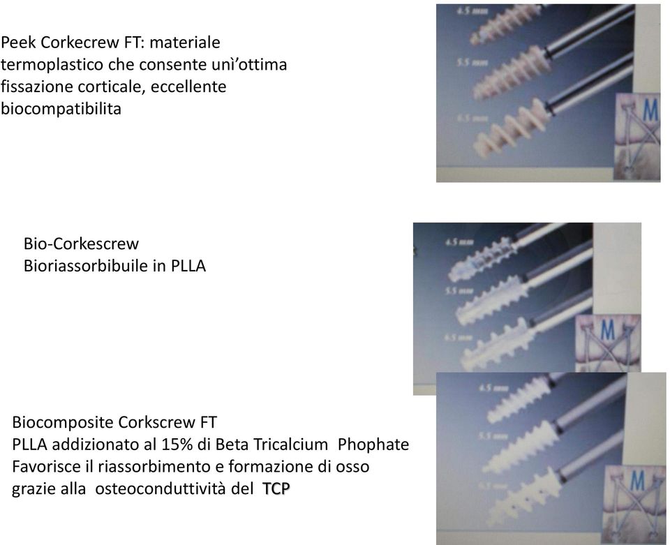 Biocomposite Corkscrew FT PLLA addizionato al 15% di Beta Tricalcium Phophate