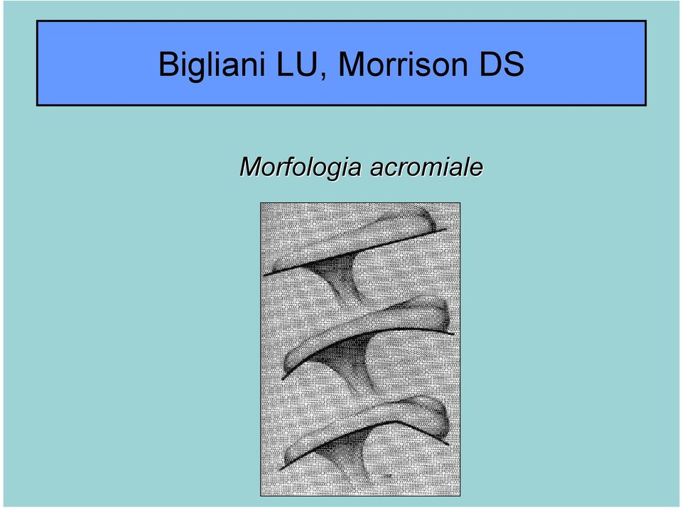 Morrison DS