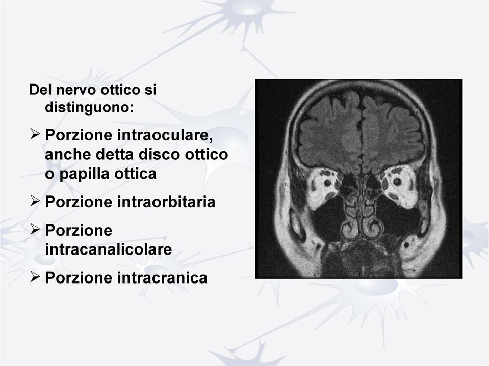 papilla ottica Porzione intraorbitaria