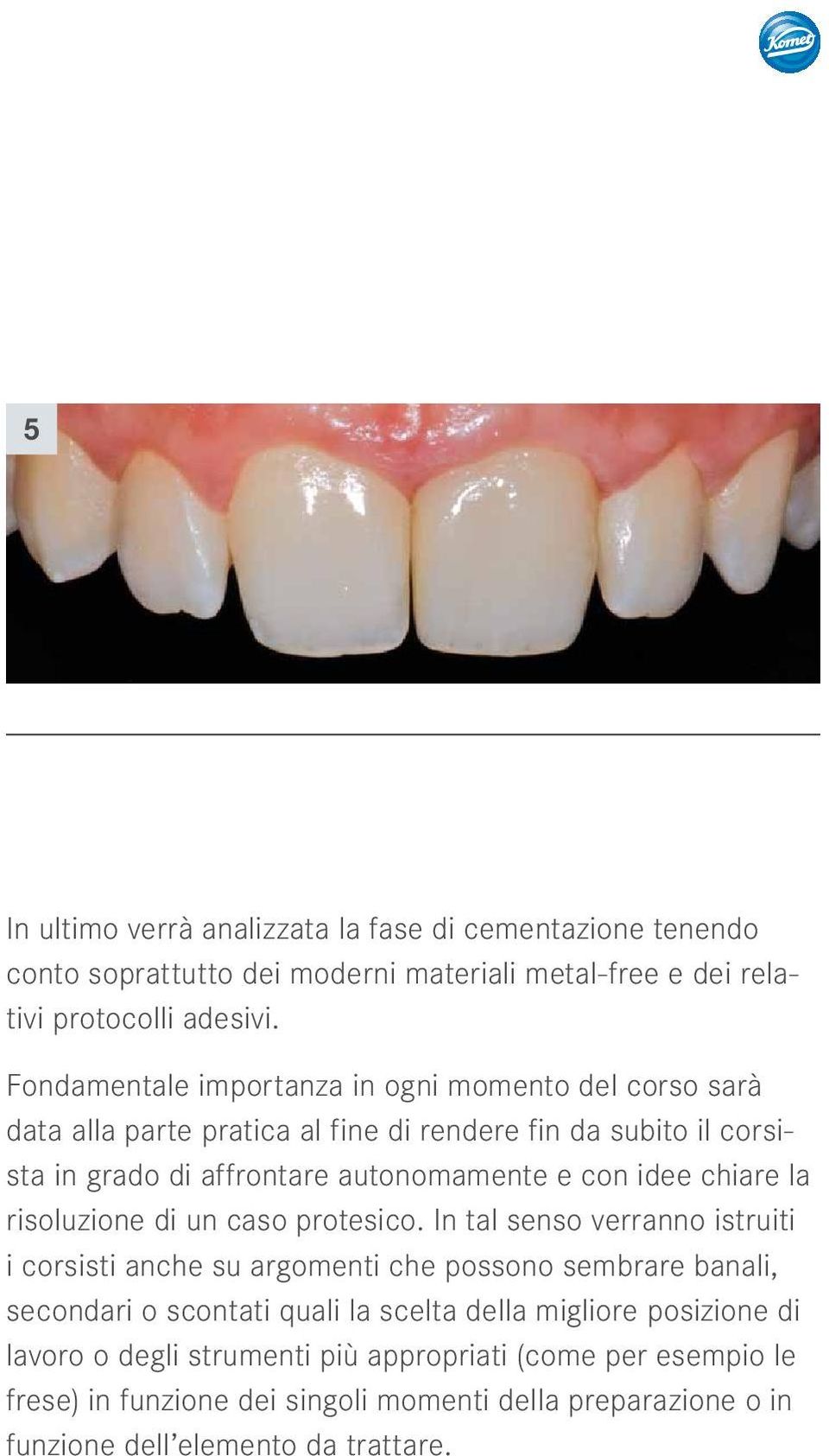 idee chiare la risoluzione di un caso protesico.