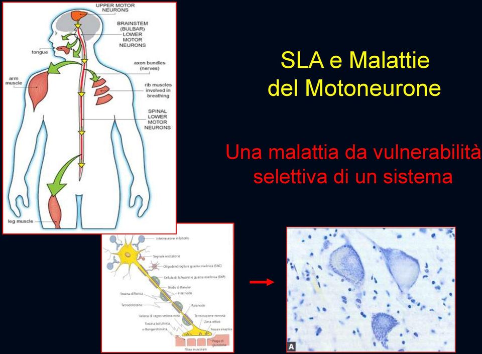 malattia da