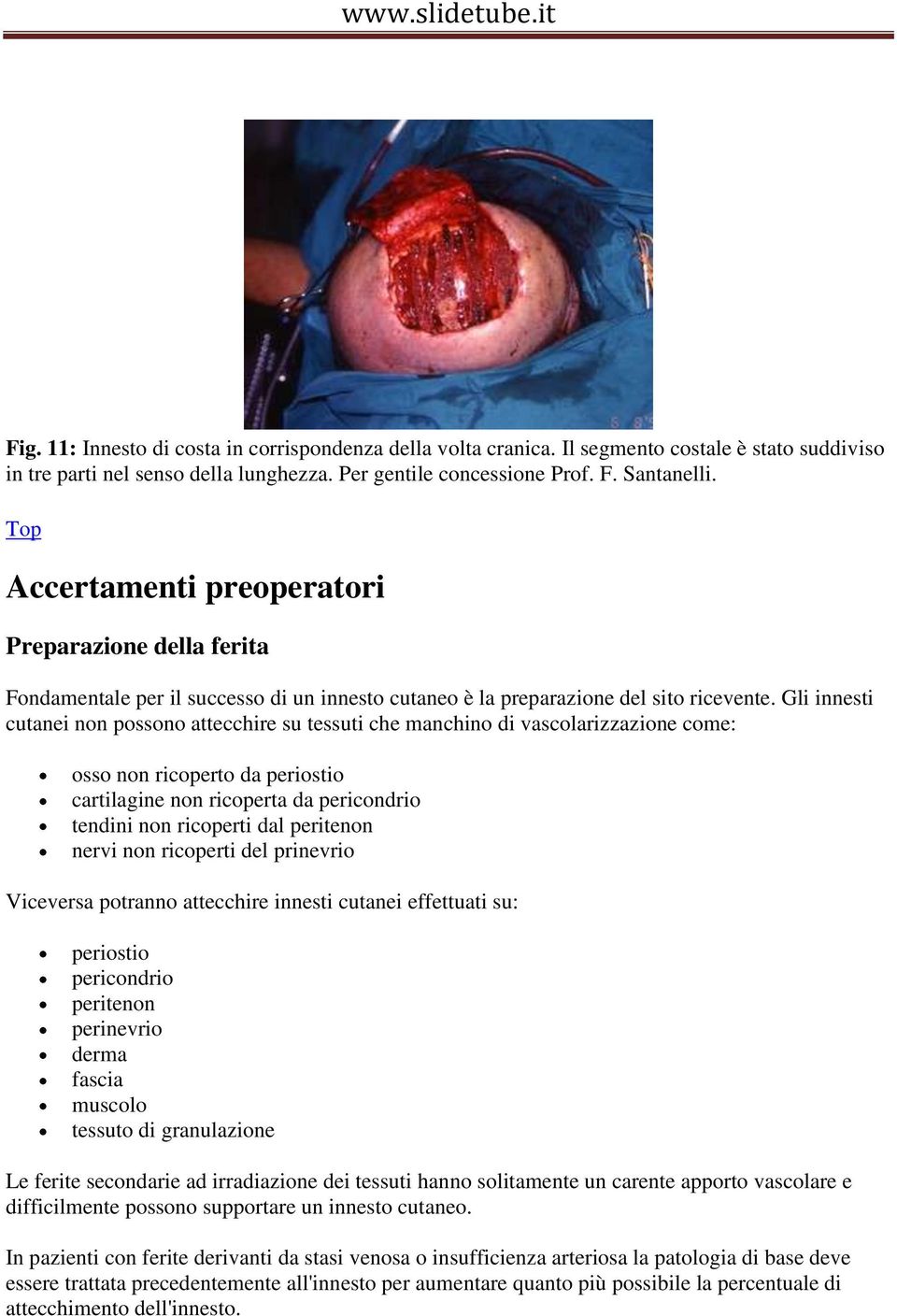 Gli innesti cutanei non possono attecchire su tessuti che manchino di vascolarizzazione come: osso non ricoperto da periostio cartilagine non ricoperta da pericondrio tendini non ricoperti dal